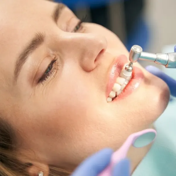 Teeth Cleaning