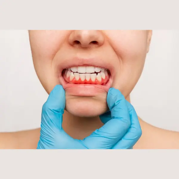 Periodontist