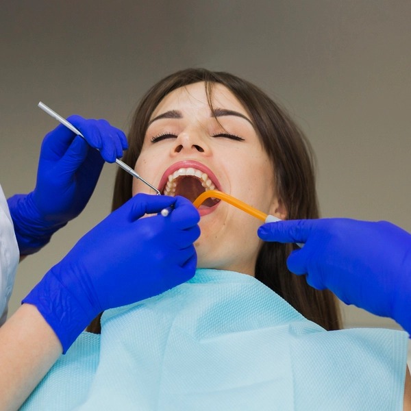 Root Canal treatment