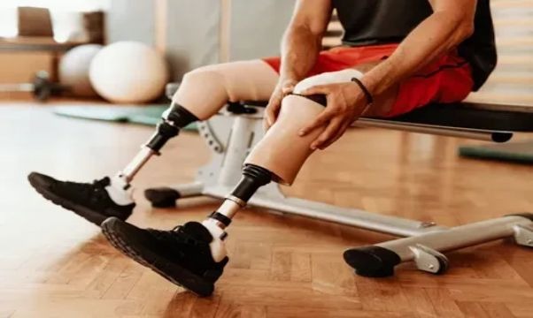 Limb Prosthetic Rehabilitation