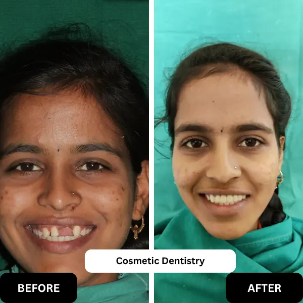 Cosmetic Dentistry