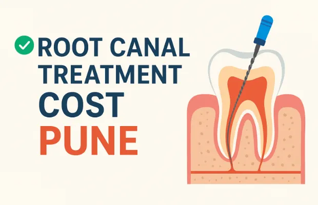 Root Canal Treatment Cost in Pune | Complete Guide by Dr. Ashwitha’s Dental Studio