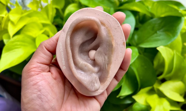 Ear Prosthetic Rehabilitation